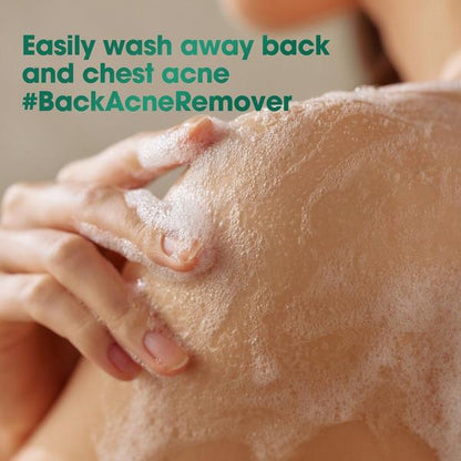 30 Days Miracle Acne Clear Body Cleanser